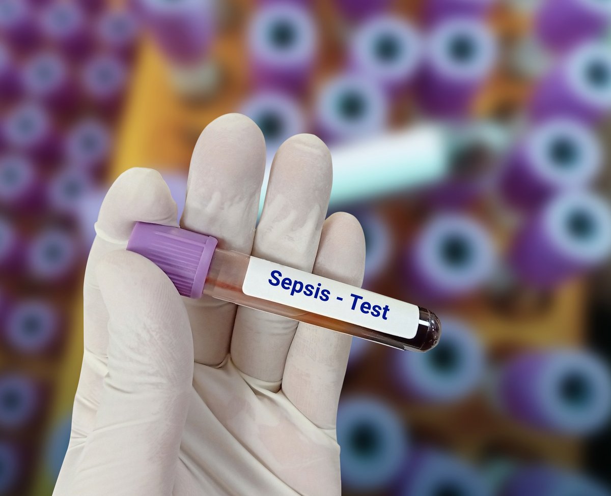 Scientist hold blood sample test tube for Sepsis -Test with laboratory background